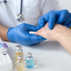 Dermatologie